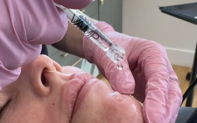 What Is VAMP™ and How Can It Transform Your Skin?